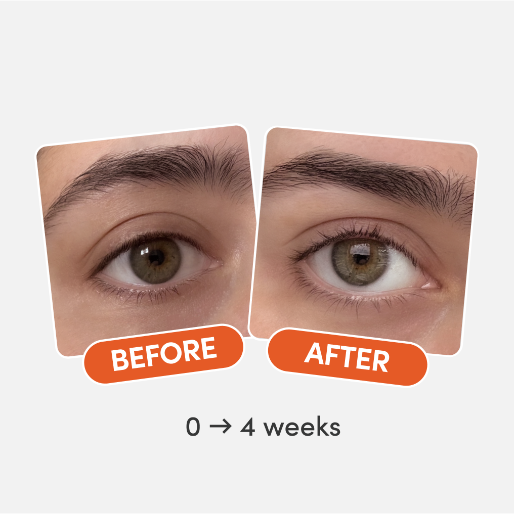 Before and after eye close-ups