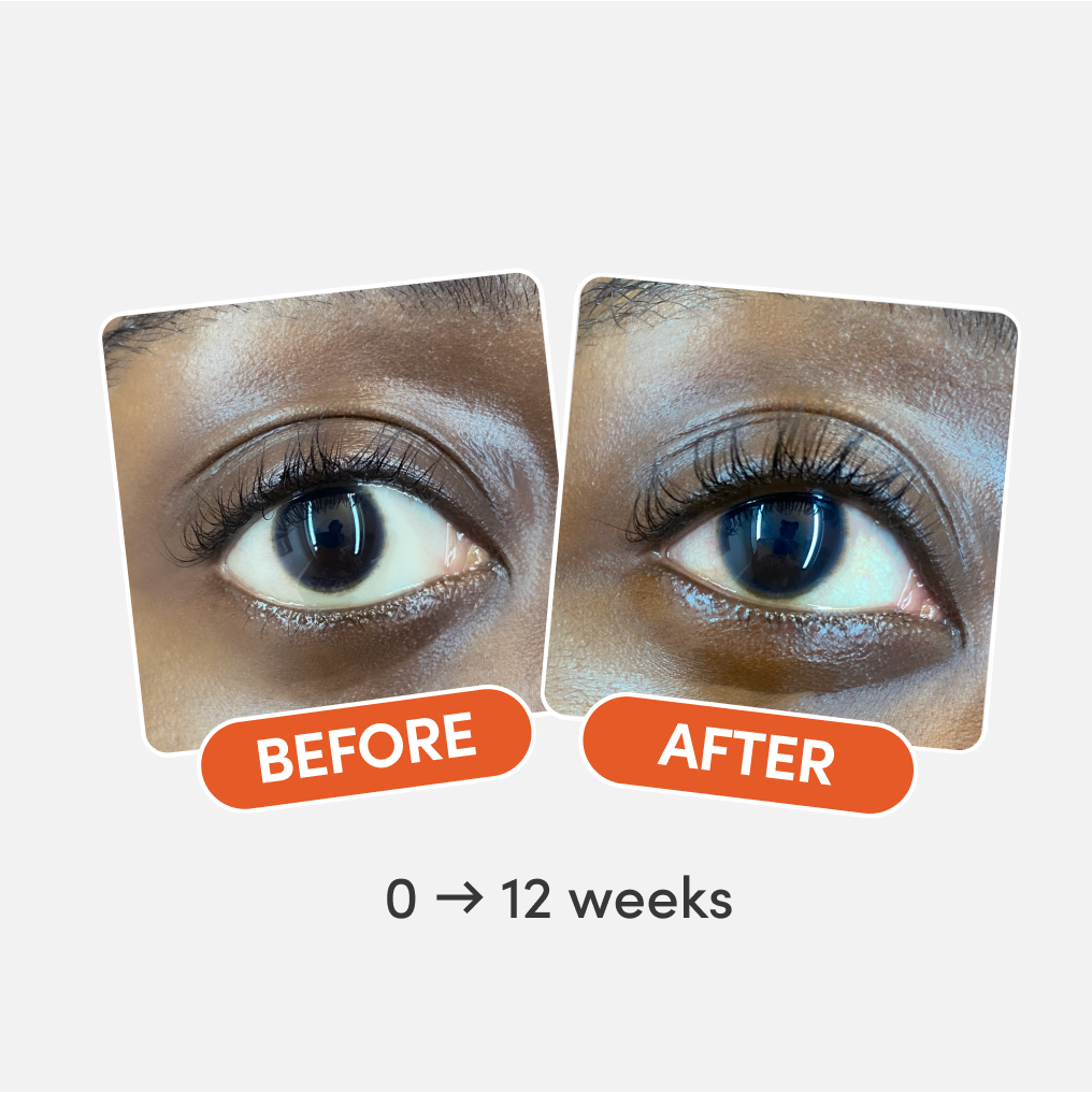 Before and after eyelash growth
